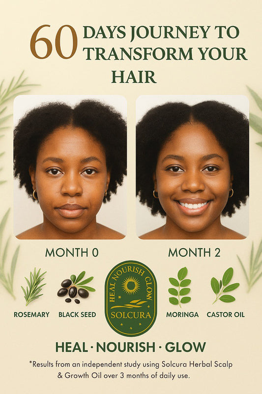 SOLCURA Herbal Scalp & Growth Oil